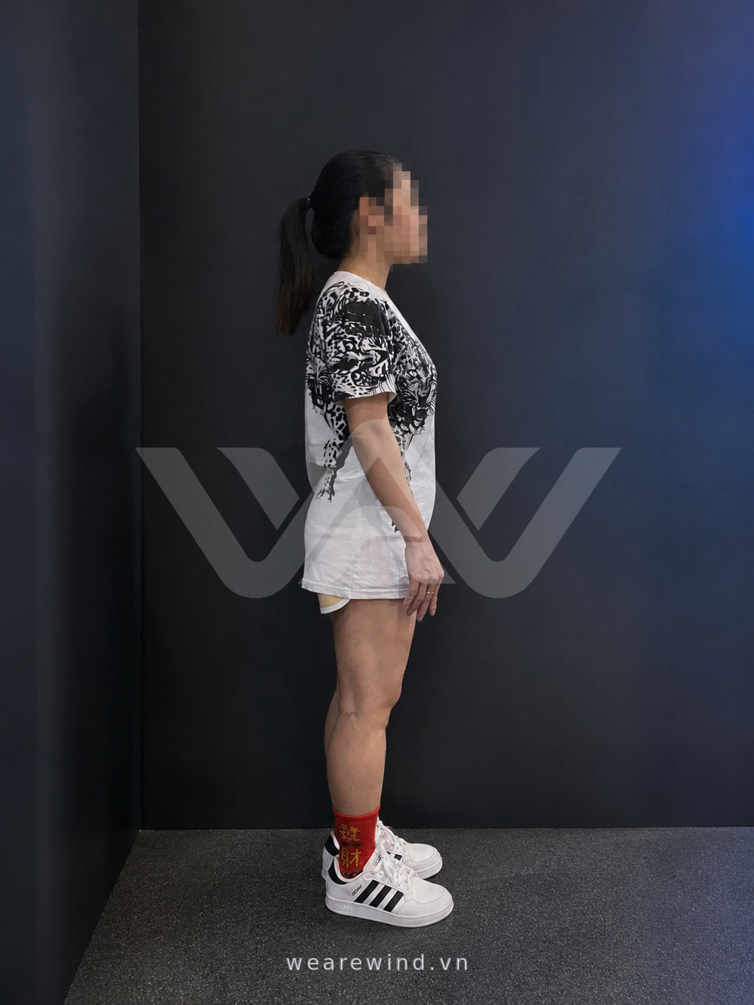 Ghi nhận tư thế nhìn bên